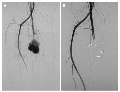 Figure 18