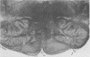 383