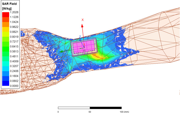 Fig. 10