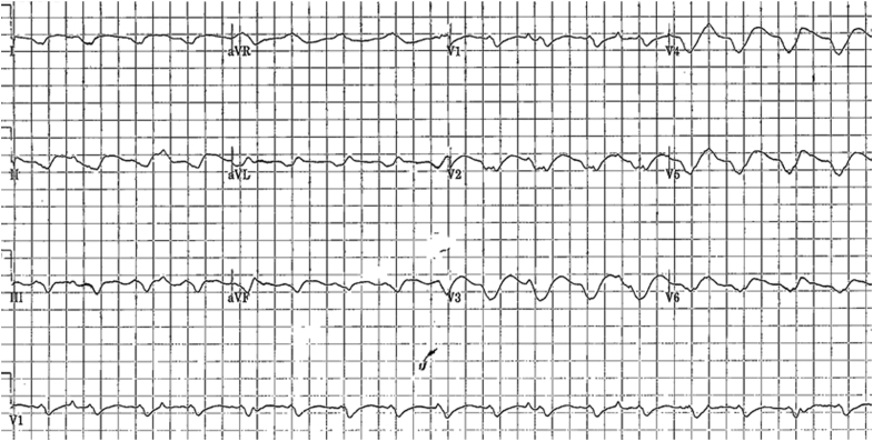 Figure 1