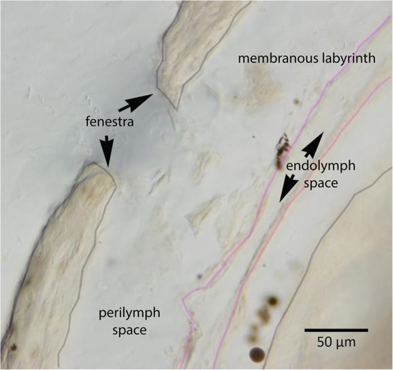 FIG. 5