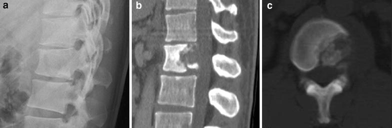 Fig. 1