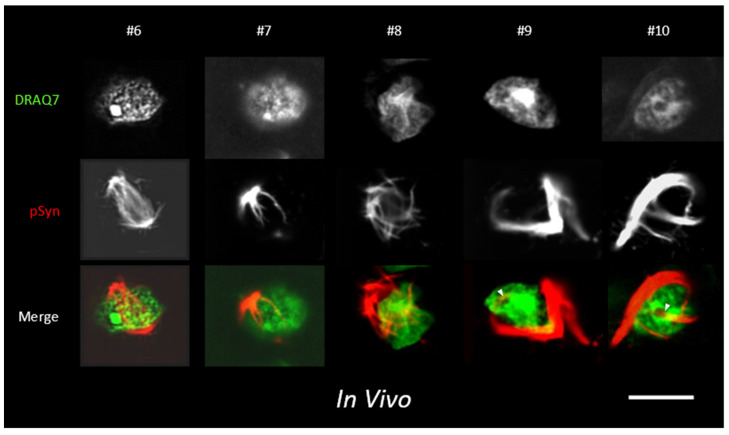 Figure 11