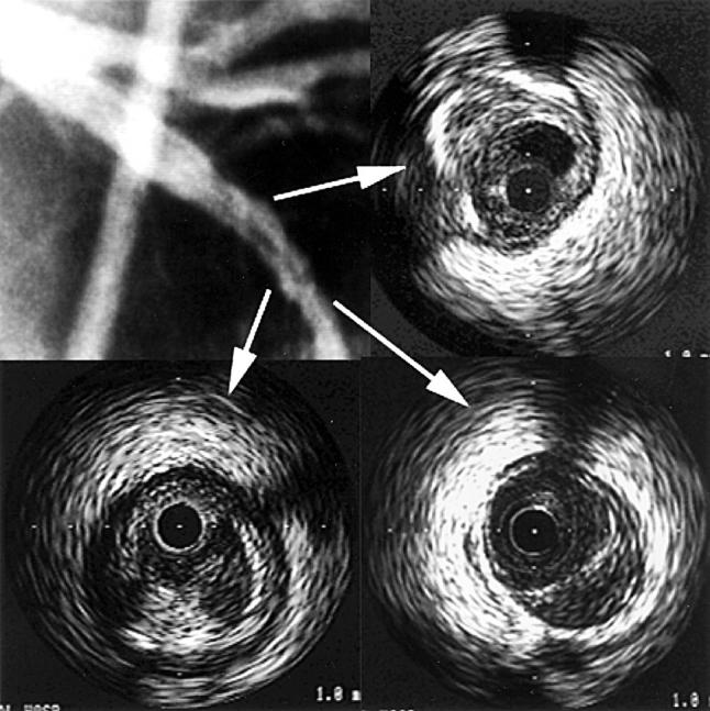 Figure 2  