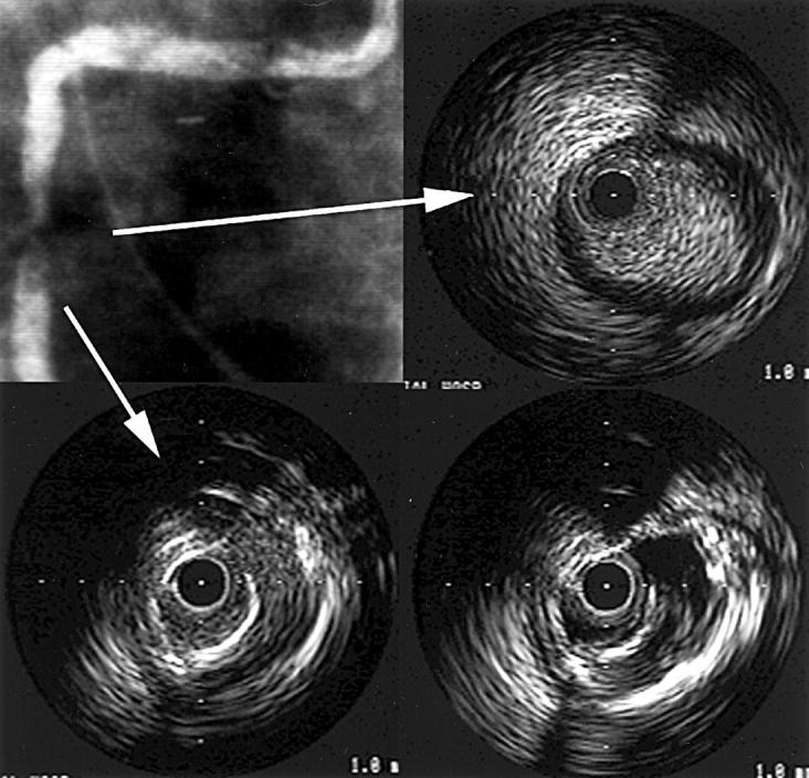 Figure 1  