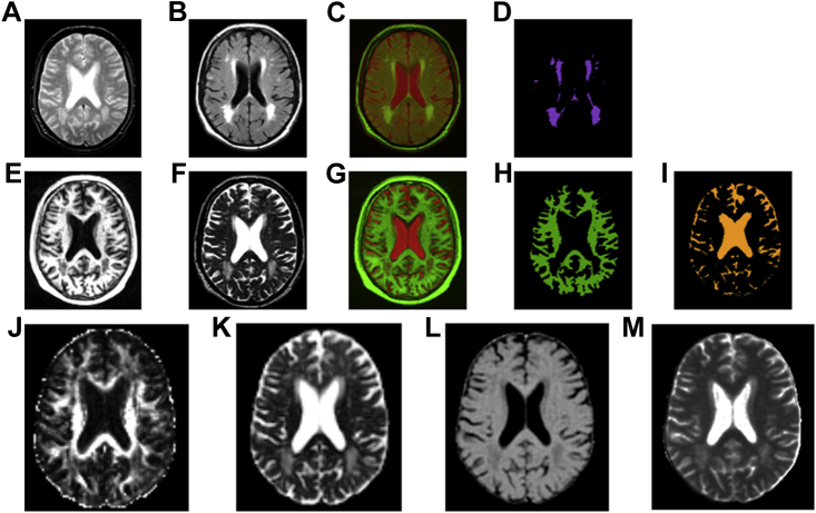 Fig. 1