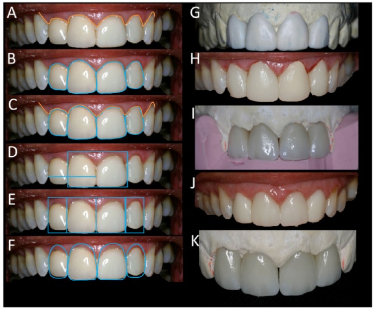 Fig. (3)