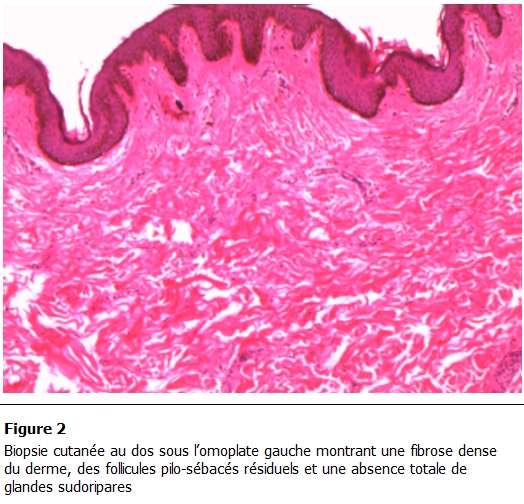 Figure 2: