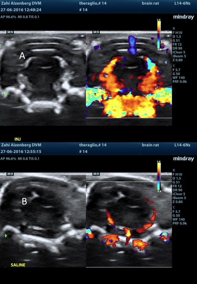 Figure 11