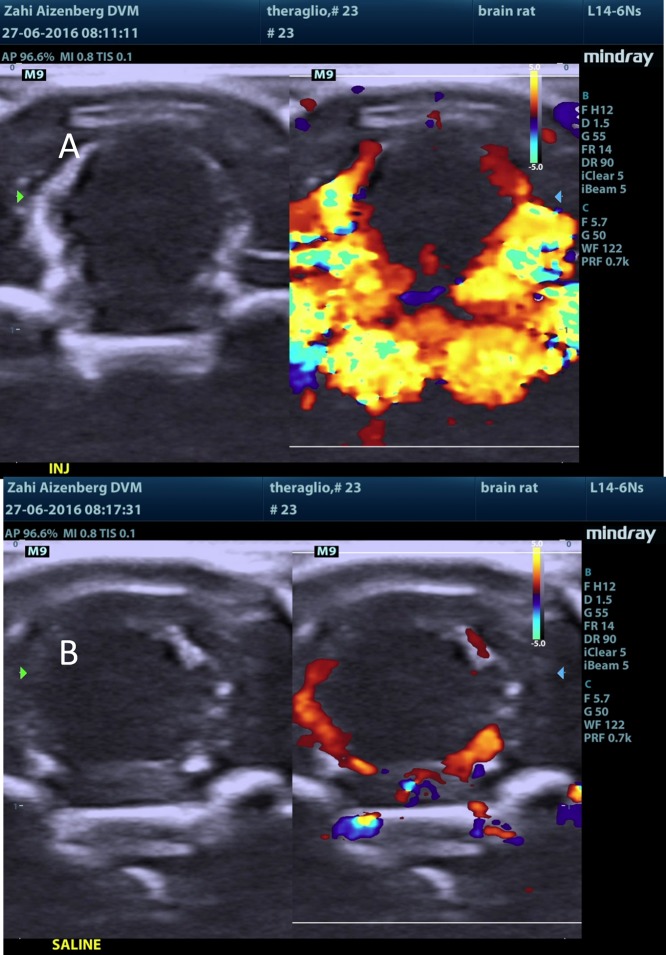 Figure 12