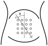 Figure 1.Electrode