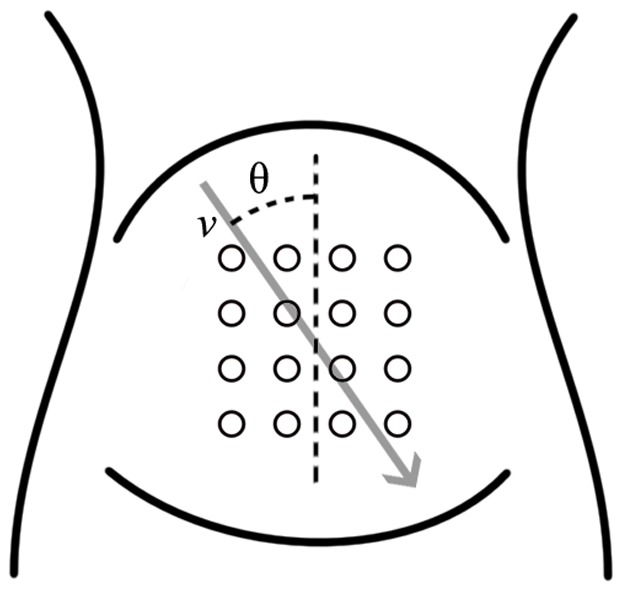 Figure 1.Electrode