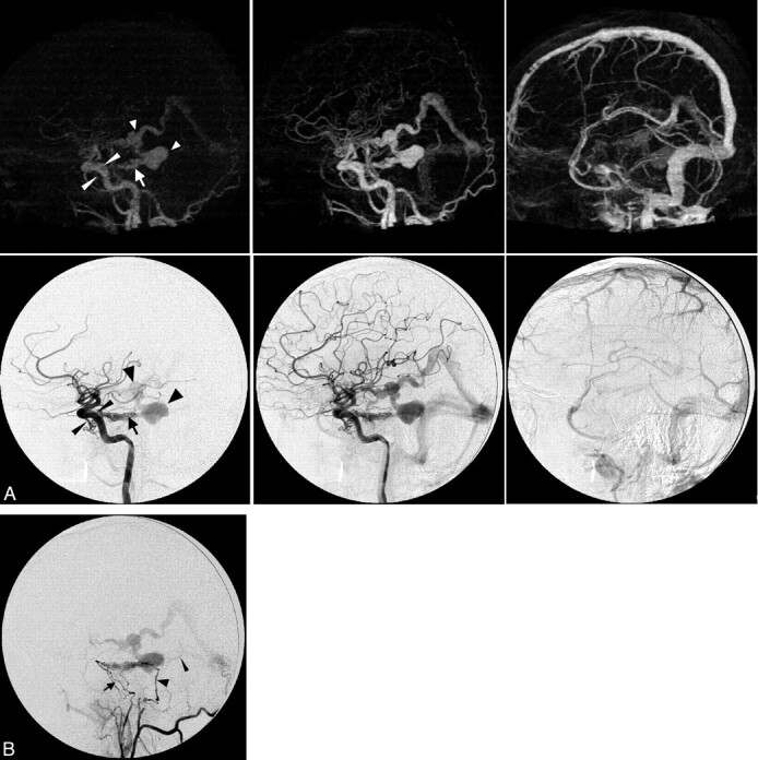 Fig 2.