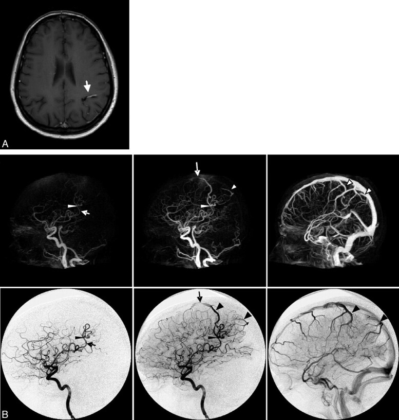 Fig 3.