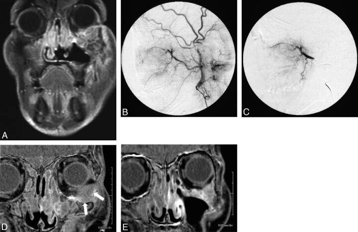 Fig 4.