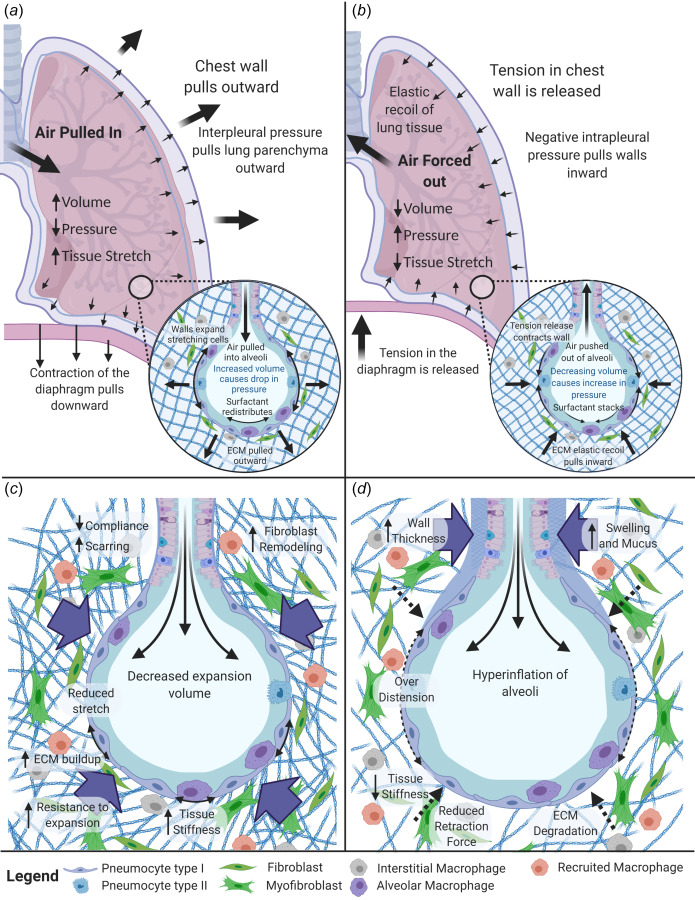 Mechanical Forces within the lung. (a) Contraction of the diaphragm and chest muscles during inhalation results in negative interpleural pressure that expands lung tissue, stretches the alveoli, and increases lung volume driving air inflow. (b) Relaxation of the diaphragm and chest muscles during expiration allows for elastic recoil that reduces lung volume and air compression that drives air outflow. (c) In restrictive diseases, fibroblast-mediated remodeling causes increased tissue stiffness which limits expansion capability during inspiration. (d) In obstructive pulmonary disease, ECM degradation leads to hyperinflation and reduced elastic recoil inhibiting full exhalation. Created with the link in a note.3