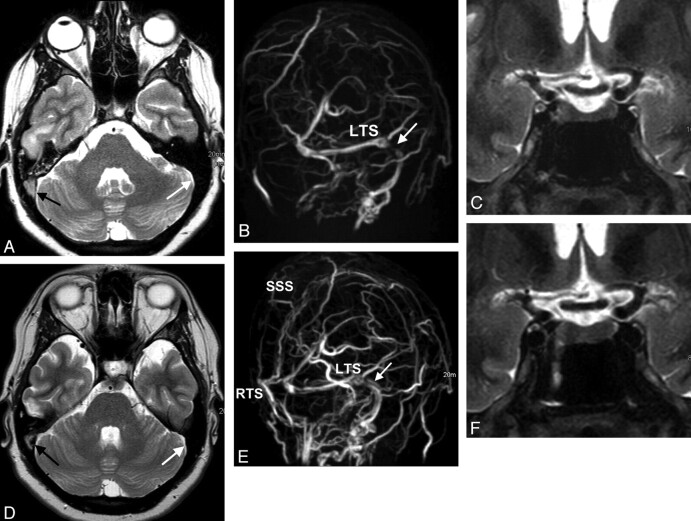 Fig 3.