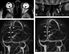 Fig 2.