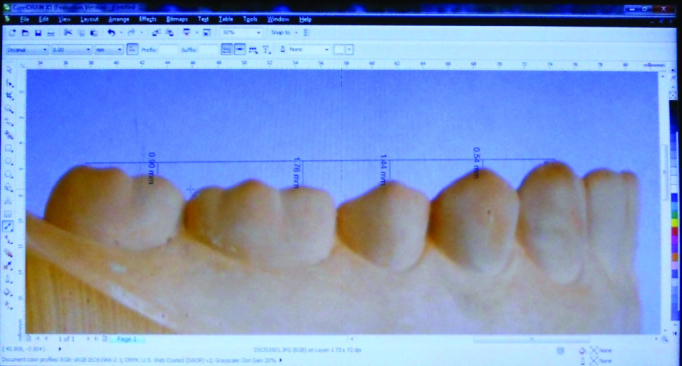 [Table/Fig-4]