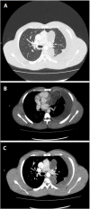 Fig. 2