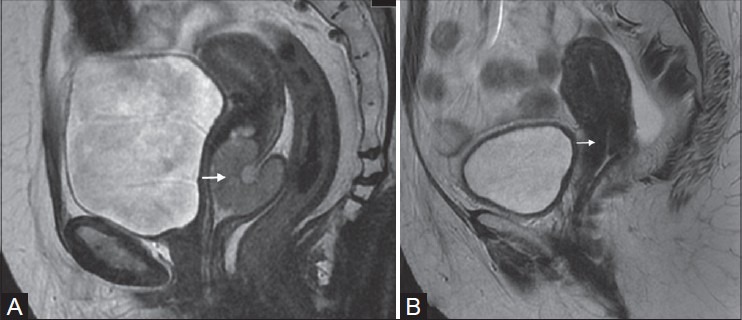 Figure 11(A, B)