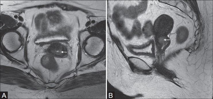 Figure 2(A, B):