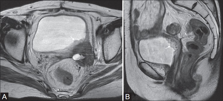 Figure 9(A, B)