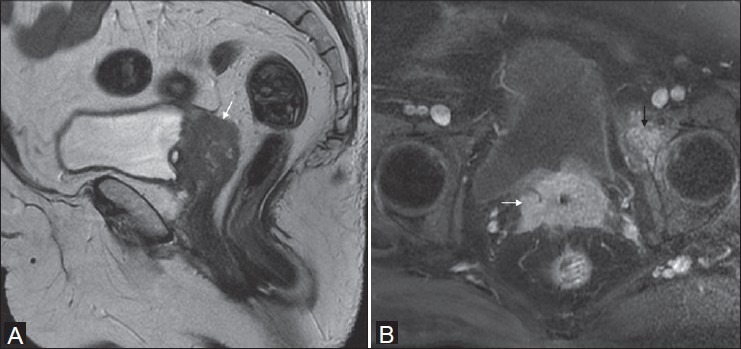 Figure 12(A, B)