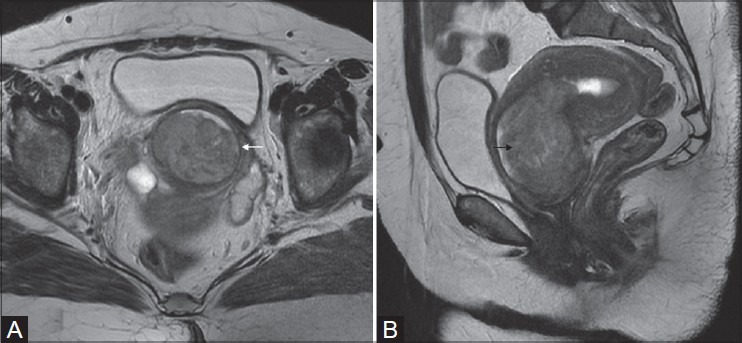 Figure 3(A, B):