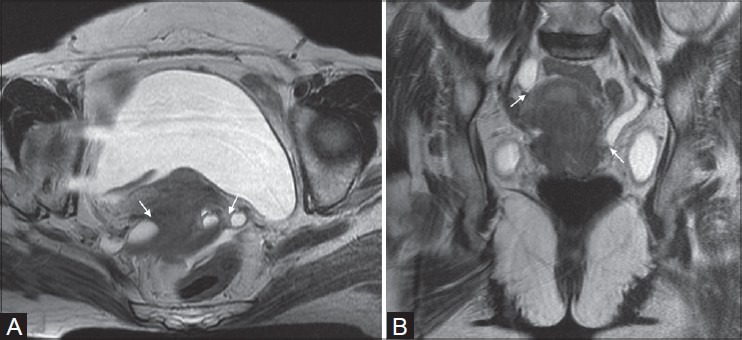 Figure 7(A, B):