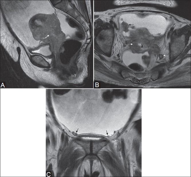 Figure 10(A-C)