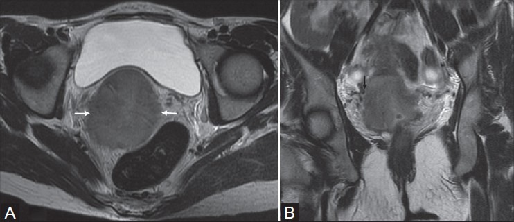 Figure 5(A, B):