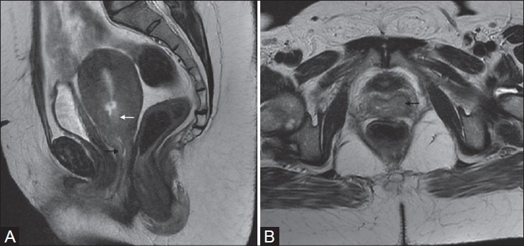 Figure 4(A, B):