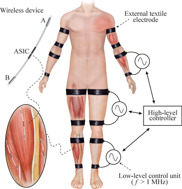 Fig. 1