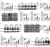 Figures 4A, 4D, 4E, 4F, 4G, 4J, 4K, 4L, and 4M are bar graphs, plotting messenger ribonucleic acid of Long isoform-nuclear respiratory factor 1 (fold of Scramble with D 0), ranging from 0 to 6 in increments of 2; Tartrate-resistant acid phosphatase positive multinucleated cells (greater than 3 total number) per well, ranging from 0 to 600 in increments of 200; Messenger ribonucleic acid of Cathepsin K (fold of Scramble with vehicle), ranging from 0 to 15 in increments of 5; Messenger ribonucleic acid of H positive-atpase (fold of Scramble with vehicle), ranging from 0 to 12 in increments of 4; Messenger ribonucleic acid of ATPase H positive Transporting V 0 Subunit D 2 (fold of Scramble with vehicle), ranging from 0 to 9 in increments of 3; Tartrate-resistant acid phosphatase positive multinucleated cells (greater than 3 total number) per well, ranging from 0 to 180 in increments of 60; Messenger ribonucleic acid of Cathepsin K (fold of Scramble with vehicle), ranging from 0 to 9 in increments of 3; Messenger ribonucleic acid of H positive-atpase (fold of Scramble with vehicle), ranging from 0 to 12 in increments of 4; and Messenger ribonucleic acid of ATPase H positive Transporting V 0 Subunit D 2 (fold of Scramble with vehicle), ranging from 0 to 15 in increments of 5 (y-axis) across Scramble, knockdown, and knockdown plus overexpression (x-axis) for vehicle and cadmium. Figure 4B is a western blot divided into two columns, namely, Scramble and Knockdown, each divided into three columns, namely, D 2, D 3, and D 4, and two rows, namely, Long isoform-nuclear respiratory factor 1 and Beta-actin. The molecular weight (kilodaltons) ranges approximately between 42, 95, and 120. Figure 4C is a stained tissue displaying three columns, namely, Scramble, Knockdown, and Double knockdown, and two rows, namely, Vehicle and Cadmium with a 200 micrometer scale bar. Figure 4H is a western blot divided into three columns, namely, Scramble, Knockdown, and Double knockdown, each divided into two columns, namely, vehicle and cadmium, and two rows, namely, Nuclear factor of activated T cells, cytoplasmic 1 and Beta-actin. Figure 4I is a stained tissue displaying three columns, namely, Scramble, Knockdown, and Knockdown plus overexpression, and two rows, namely, Vehicle and Cadmium with a 200 micrometer scale bar. Figure 4N is a western blot divided into three columns, namely, Scramble, Knockdown, and Knockdown plus overexpression, each divided into two columns, namely, vehicle and cadmium, and two rows, namely, Nuclear factor of activated T cells, cytoplasmic 1 and Beta-actin.