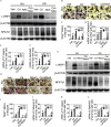 Figure 5A is a set of two western blots divided into two columns, namely, Scramble and Knockdown, each divided into four columns, namely, vehicle, cadmium, N-acetylcysteine, cadmium plus N-acetylcysteine, and four rows, namely, Long isoform-nuclear respiratory factor 1 and Beta-actin, and Nuclear factor of activated T cells, cytoplasmic 1 and Beta-actin. Figure 5B is a stained tissue displaying four columns, namely, vehicle, cadmium, N-acetylcysteine, cadmium plus N-acetylcysteine, and two rows, namely, Scramble and Knockdown with a 200 micrometer scale bar. Figures 5C, 5D, 5E, 5F, 5I, 5J, 5K, and 5L are bar graphs, plotting Tartrate-resistant acid phosphatase positive multinucleated cells (greater than 3 total number) per well, ranging from 0 to 180 in increments of 60; Messenger ribonucleic acid of Cathepsin K (fold of Scramble with vehicle), ranging from 0 to 60 in increments of 20; Messenger ribonucleic acid of H positive-atpase (fold of Scramble with vehicle), ranging from 0 to 30 in increments of 10; Messenger ribonucleic acid of ATPase H positive Transporting V 0 Subunit D 2 (fold of Scramble with vehicle), ranging from 0 to 20 in increments of 5; Tartrate-resistant acid phosphatase positive multinucleated cells (greater than 3 total number) per well, ranging from 0 to 240 in increments of 80; Messenger ribonucleic acid of Cathepsin K (fold of Scramble with vehicle), ranging from 0 to 90 in increments of 30; Messenger ribonucleic acid of H positive-atpase (fold of Scramble with vehicle), ranging from 0 to 30 in increments of 10; and Messenger ribonucleic acid of ATPase H positive Transporting V 0 Subunit D 2 (fold of Scramble with vehicle), ranging from 0 to 40 in increments of 10 (y-axis) across vehicle, cadmium, mitoquinone mesylate, and cadmium plus mitoquinone mesylate (x-axis) for scramble and knockdown. Figure 5H is a stained tissue displaying four columns, namely, vehicle, cadmium, mitoquinone mesylate, and cadmium plus mitoquinone mesylate, and two rows, namely, Scramble and Knockdown with a 200 micrometer scale bar. Figure 5G is a set of two western blots divided into two columns, namely, Scramble and Knockdown, each divided into four columns, namely, vehicle, cadmium, mitoquinone mesylate, and cadmium plus mitoquinone mesylate, and four rows, namely, Long isoform-nuclear respiratory factor 1 and Beta-actin, and Nuclear factor of activated T cells, cytoplasmic 1 and Beta-actin.