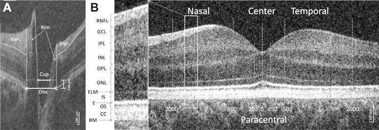 Figure 1