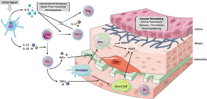 Current developments in the diagnosis and treatment of giant cell ...