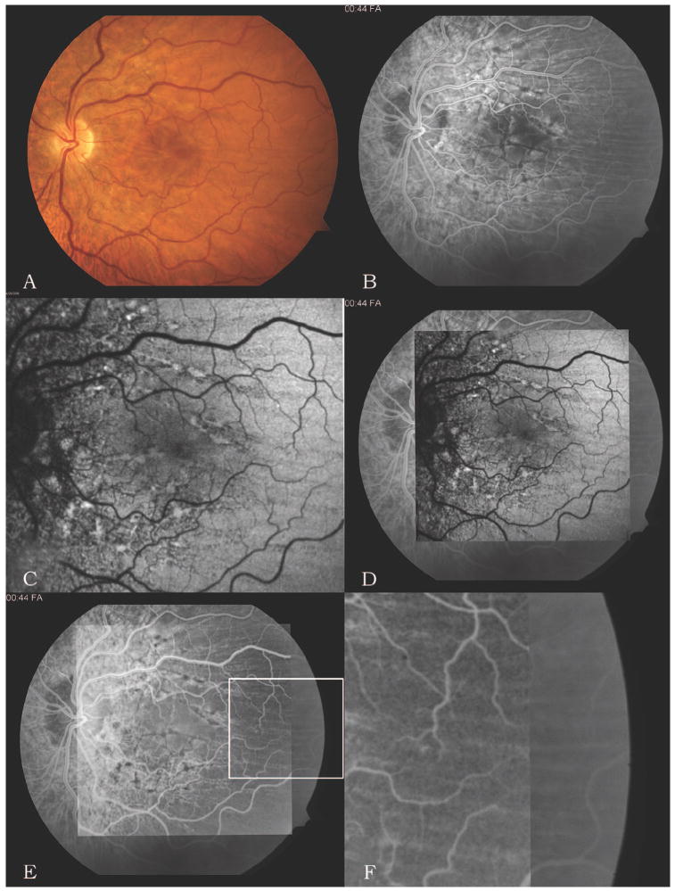 Fig. 1