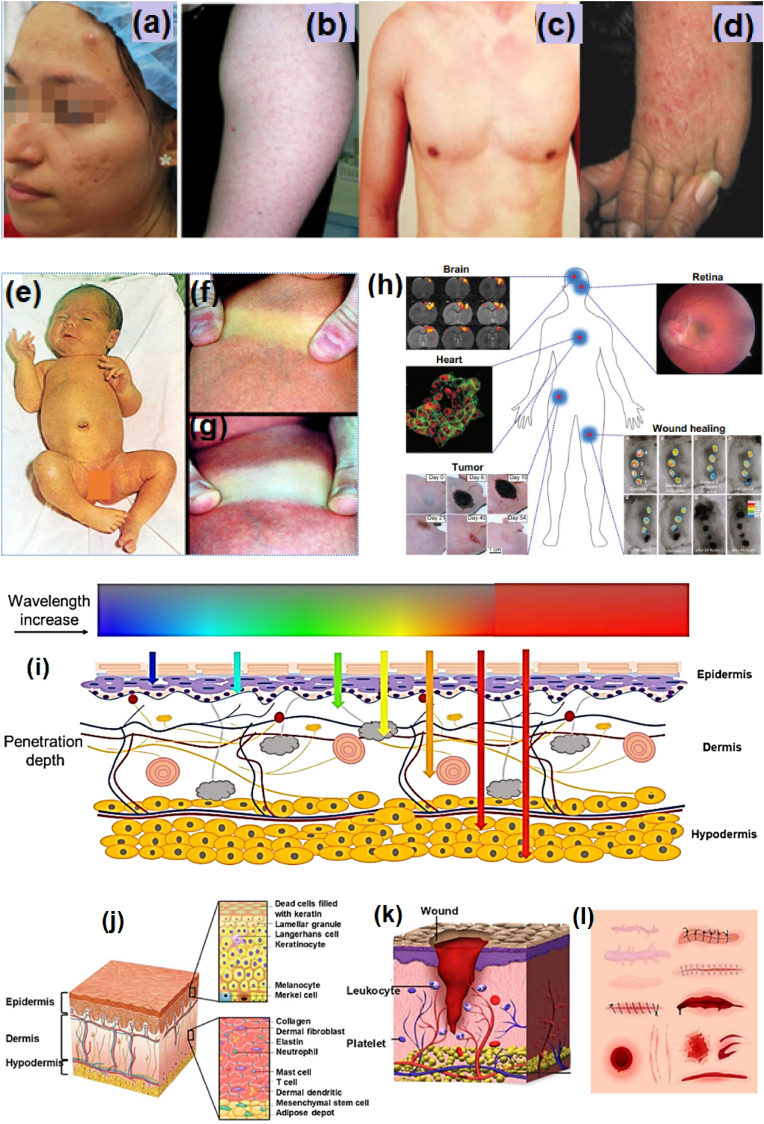 Fig. 18