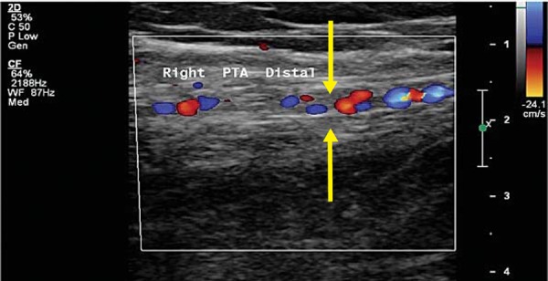 Figure 3b