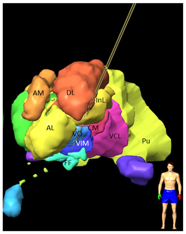 FIGURE 2