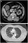 FIGURE 1: