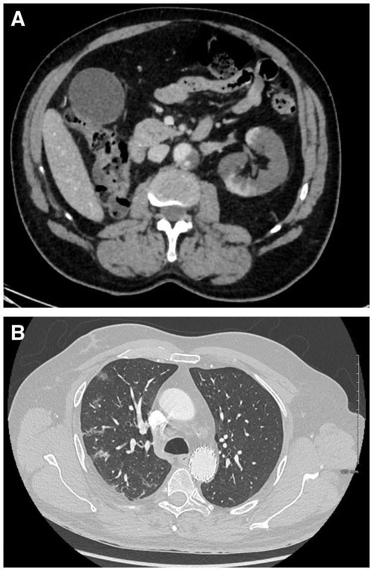 FIGURE 1: