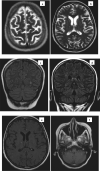Fig 2 –