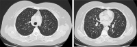 Fig 1 –