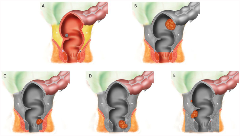 Figure 5: