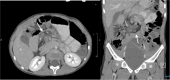 Fig 2: