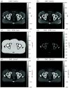 Fig. 13