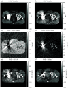 Fig. 17